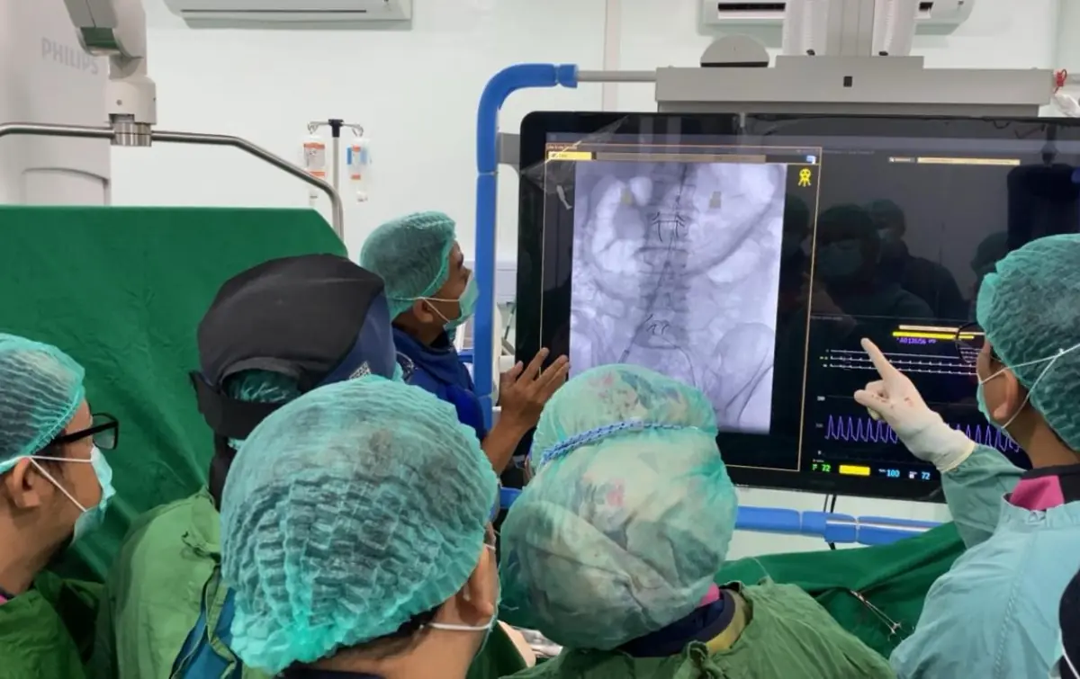 Penanganan Pembesaran Pembuluh Darah di Perut, EVAR Hadir di RS Adam Malik
